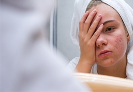 Problème de peau : Astuces et solutions pour y remédier